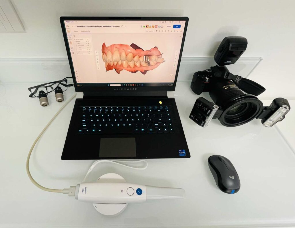 Scanner intraorale